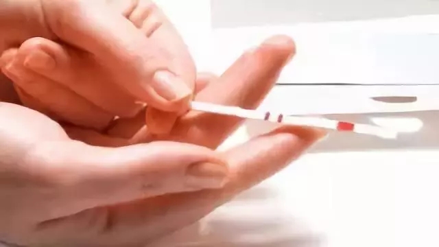 无痛人流