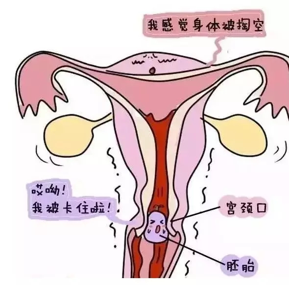 人流