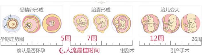 不同种类的人流各自特点是什么？